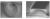 Ultrathin silicon nitride microring resonator for biophotonic applications at 970 nm wavelength